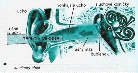 Medovková ušná sviečka - veľké balenie 10 ks